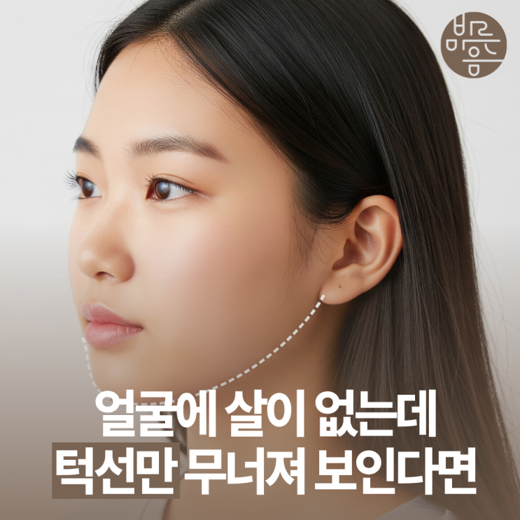 마곡슈링크유니버스 얼굴엔 살이 없는데 턱선만 흐릿할 때