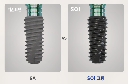 오스템임플란트 비교