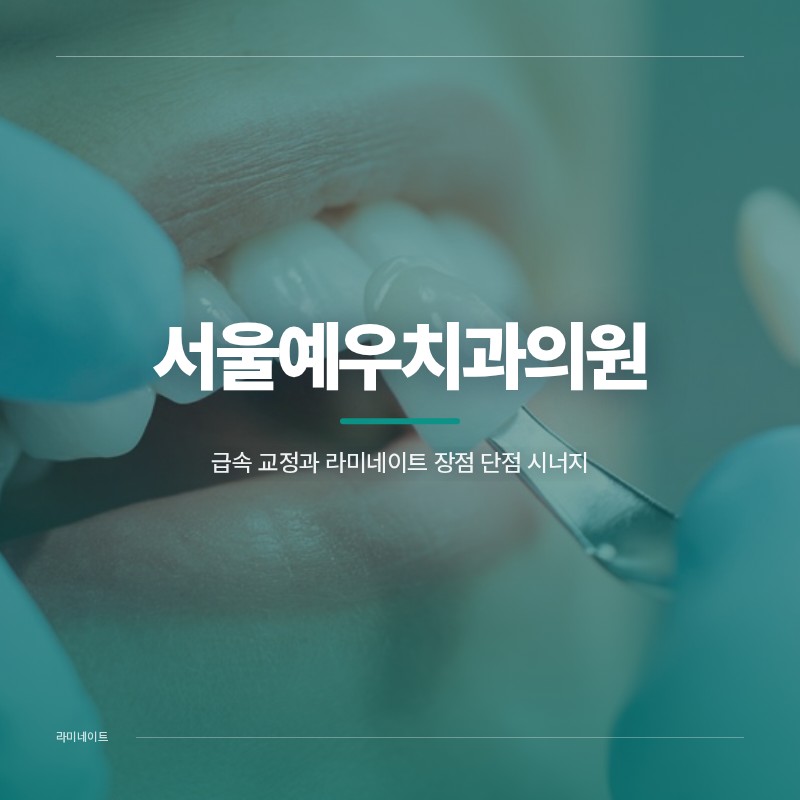 급속 교정과 라미네이트 장점 단점 시너지