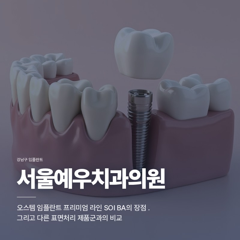 강남구 임플란트, 오스템 임플란트 프리미엄 라인 SOI BA의 장점 그리고 다른 표면처리 제품군과의 비교